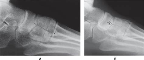 6: Normal Variants and Anomalies | Musculoskeletal Key