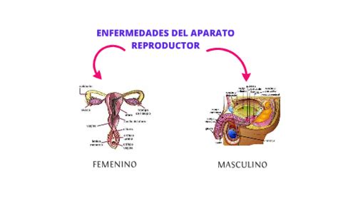 Enfermedades Del Aparato Reproductor Masculino Y Femenino By Julieth