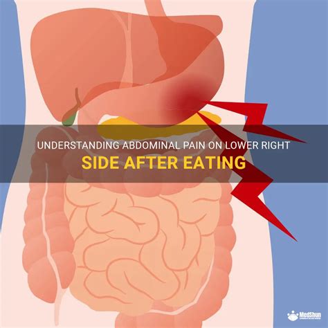 Understanding Abdominal Pain On Lower Right Side After Eating Medshun