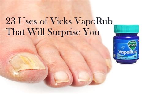 Uses Of Vicks VapoRub That Will Surprise You Treating From Head To Toe Nails