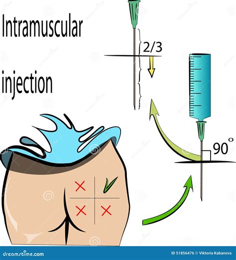 Intramuscular Injection Rules Stock Vector Image 51856476