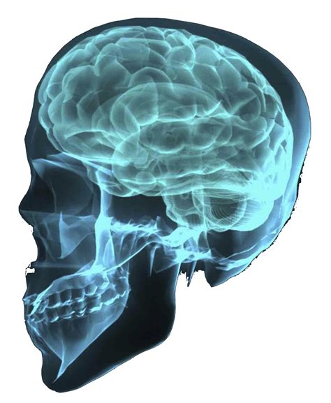 X-Ray PNG Transparent Image | PNG Arts