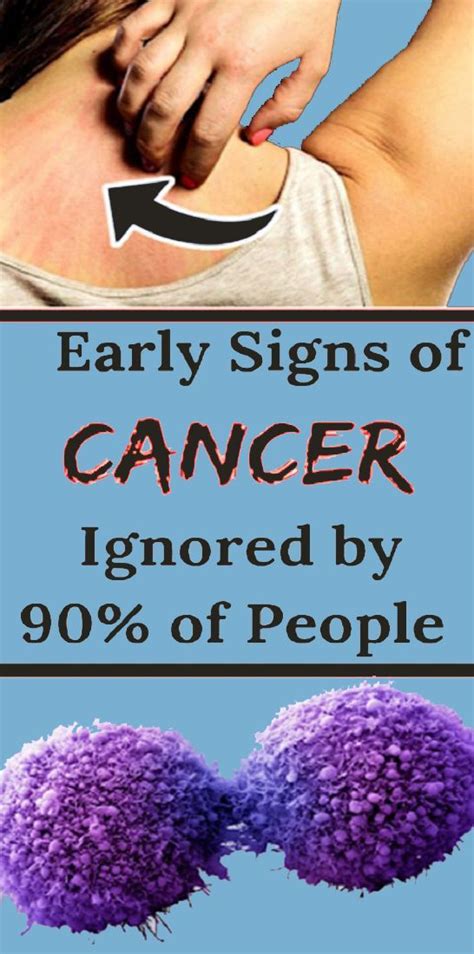 10 Signs Of Cancer That Women Shouldn’t Ignore Health And Tips
