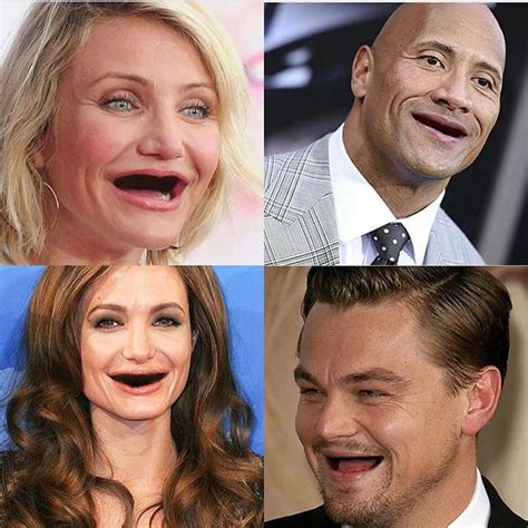 Celebrities Without Teeth Celebrities Dentist In Teeth