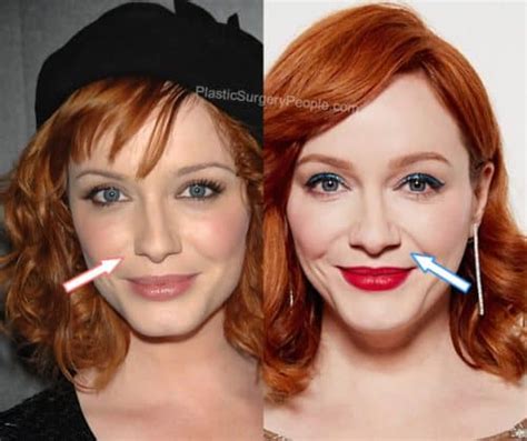 Christina Hendricks Before And After 2022