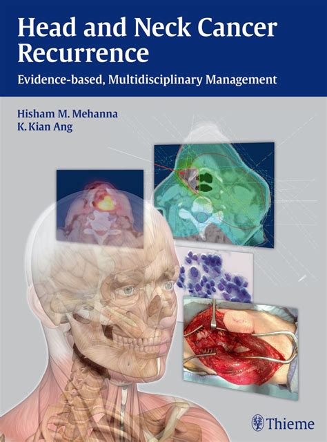 Head And Neck Cancer Recurrence 9783131473912 Thieme Webshop
