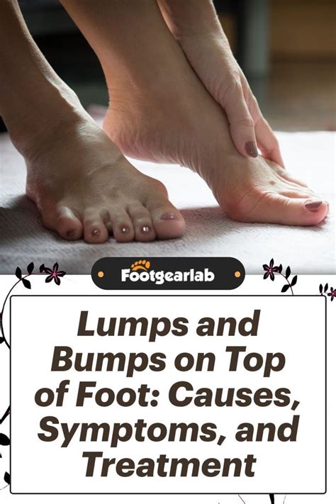 Lumps And Bumps On Top Of Foot Causes Symptoms And Treatment Artofit