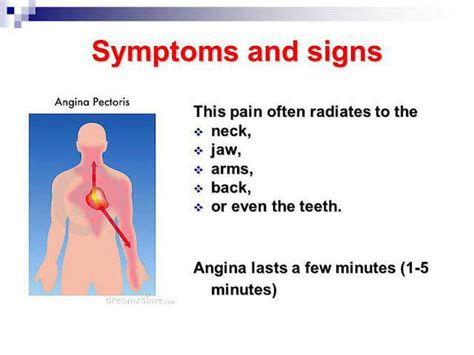 Symptoms Of Angina Medizzy