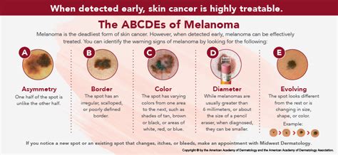The Serious Side Of Skin Cancer Midwest Dermatology Midwest Dermatology