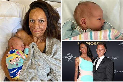 Turia Pitt Gives Birth To A Healthy Baby Boy Who Magazine