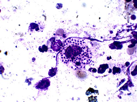 Leishmania Species Parasitology
