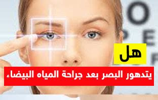 نوع التعليق ملاحظة علمية ملاحظة إملائية طلب ترجمة الجواب طلب توضيح للجواب. هل يتدهور البصر بعد جراحة المياه البيضاء