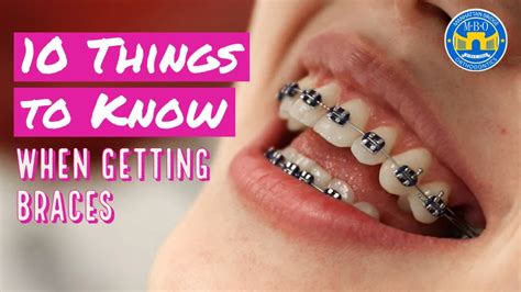 10 Things To Know When Getting Braces Youtube