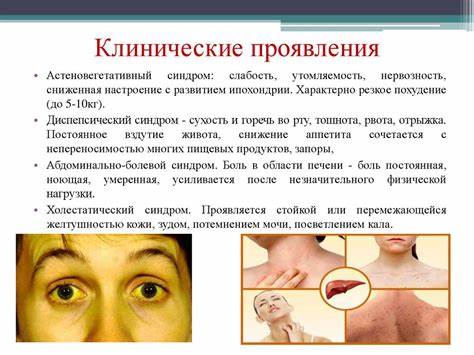 Хронический гепатит диета 5 Хронический гепатит В - презентация онлайн Хронический гепатит В - презентация онлайн Хронический гепатит диета 5