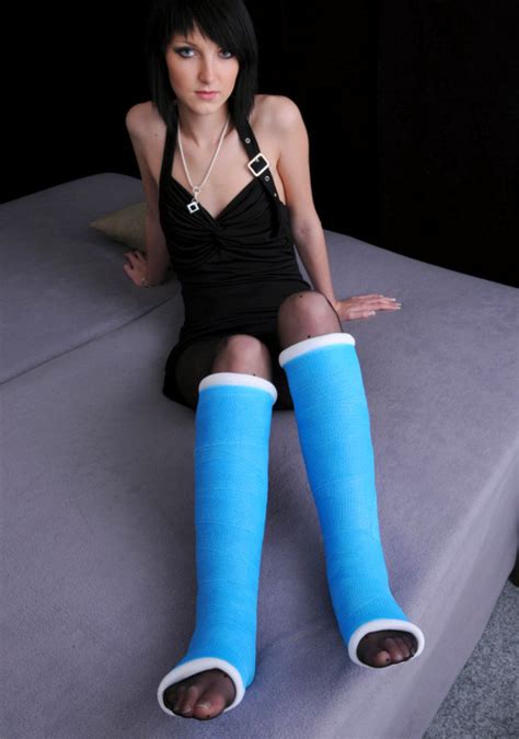 Thumbspro Double Short Leg Casts And Pantyhose Medical Fetish Feet Cast Fetish Plaster