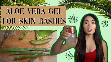 Aloe Vera Gel For Skin Rashes Youtube