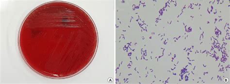 Figure 1 From A Case Of Urinary Tract Infection Caused By The Emerging