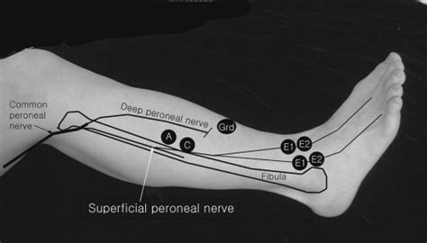 Lower Extremity Musculoskeletal Key