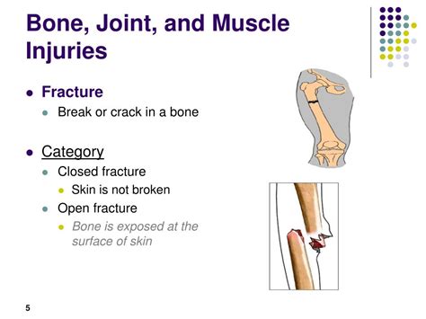 Ppt Bone Joint And Muscle Injuries Powerpoint Presentation Free