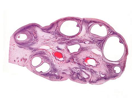 Human Ovary Histology Photograph By Microscapescience Photo Library