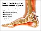 The surgeons will put you in a achilles orthotics. Is Achilles Tendon Rupture a Common Injury|Causes ...