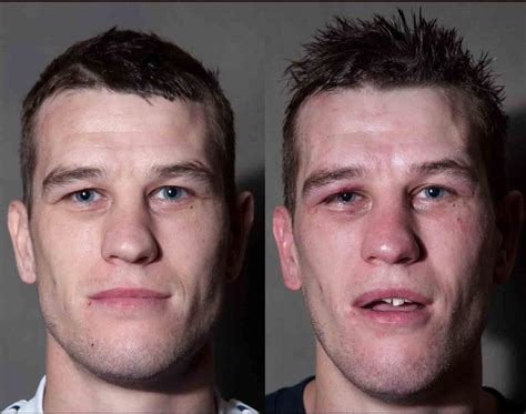 Boxers Before And After Their Fights Bruises Makeup Injury Makeup