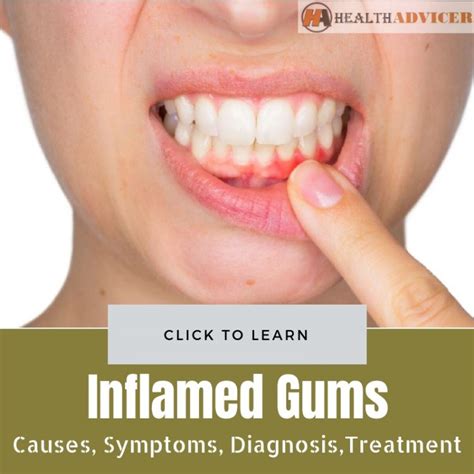 Inflamed Gums Causes Symptoms Diagnosis And Treatment
