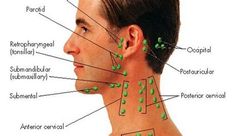 The lymph nodes and other lymphoid tissues in the head and neck are often swollen and create inflammations, which are encountered by doctors regularly. Lymph nodes of head & neck | Oral Facial | Pinterest ...