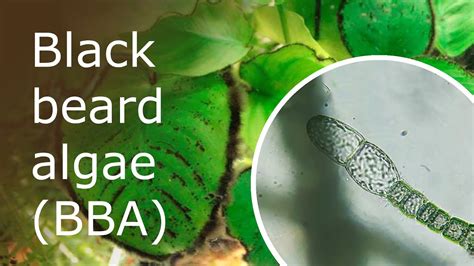 Black Beard Algae Bba Under A Microscope Youtube