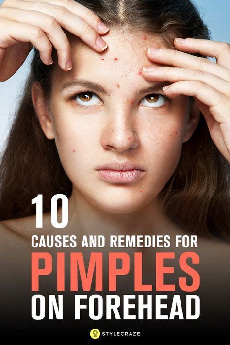 How To Get Rid Of Pimples On Forehead Pimples On Forehead Pimples