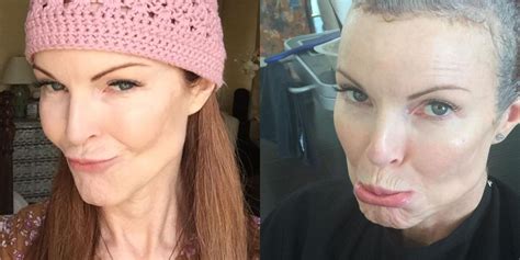 Marcia Cross Reveals She Had Anal Cancer On Instagram
