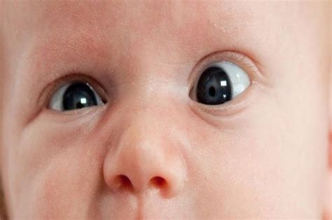 Bayi Sakit Mata 3 Cara Mengatasi Masalah Tahi Mata Pada Bayi