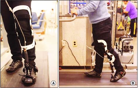 Gait Training With Pneumatic Powered Knee Ankle Foot Orthosis On