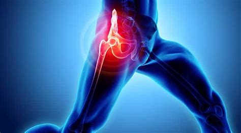 What Is Causing Sudden Sharp Hip Pain Injury Health Blog