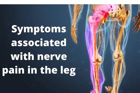 Nerve Pain In The Leg Causes Symptoms Treatment Exercise