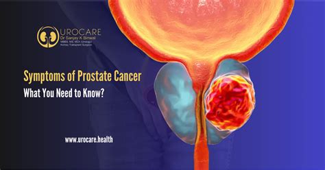Symptoms Of Prostate Cancer What You Need To Know
