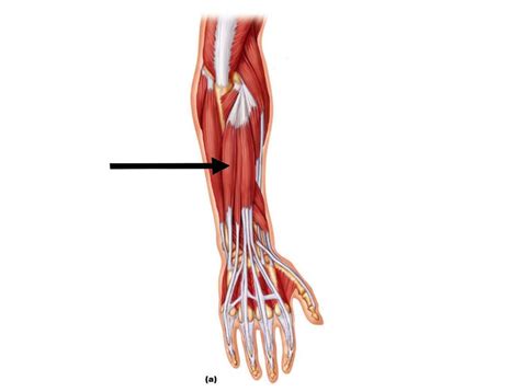 How to tell if my wrist tendon is torn and what level it is? answered by dr. U4 L41 Forearm Muscles - wrist at University of New England - StudyBlue