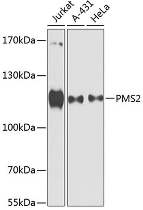 Pms2 Polyclonal Antibody Pa5 89357