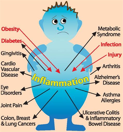 Prolonged inflammation, known as chronic inflammation, leads to a progressive shift in the type of cells present at the site of inflammation, such as mononuclear cells, and is characterized by simultaneous destruction and healing of the tissue from the inflammatory process. INFLAMMATION - Myremedy