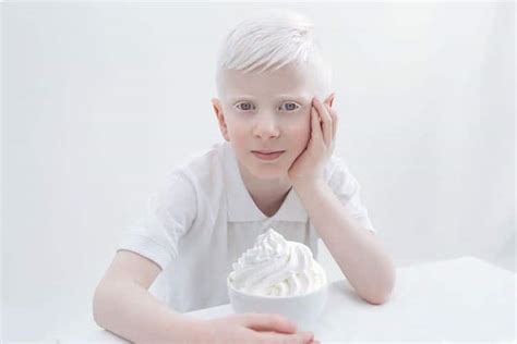 Series Of Albinism Pictures Shows Ethereal Beauty Of People With Albinism
