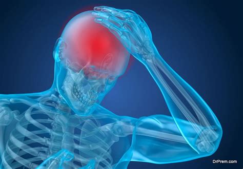 A stroke, also referred to as a cerebral vascular accident (cva) or a brain attack, is an interruption many don't realize that stroke needs the same emergency treatment as a heart attack and every. 9 Essential Cerebral Edema Treatment Guidelines