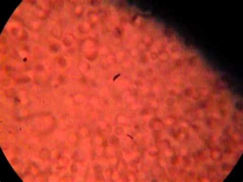 Wallpaper hd of red, nose, mouth, blood. Red blood cells 1000x magnification - YouTube