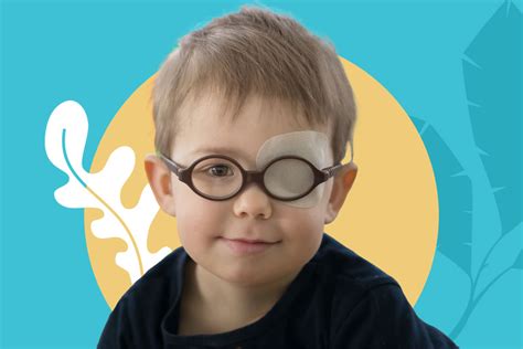 Amblyopia Lazy Eye All You Need To Know