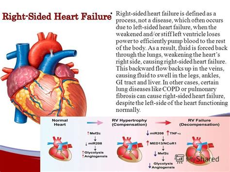 Heart Disease Process Cardiovascular Disease