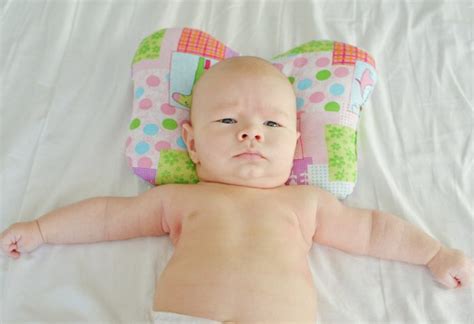 Torticollis In Infants Reasons Signs And Treatment