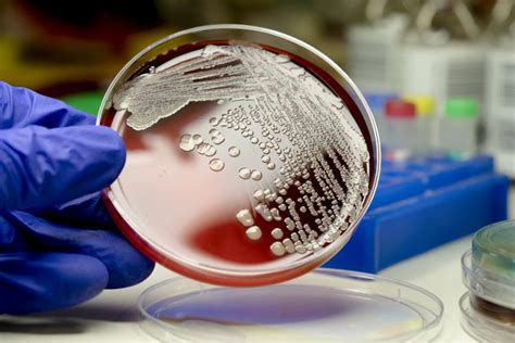 The Rise Of The Latest Drug Resistant Superbug Pursuit By The