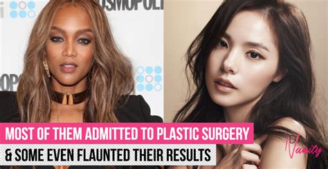 10 Celebrities Who Have Had Dramatic Plastic Surgery Transformations