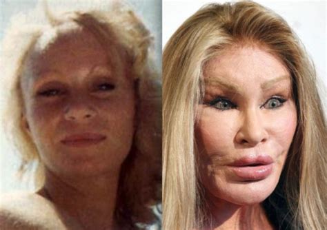 wtf has beth stern had plastic surgery shocking the dawg shed