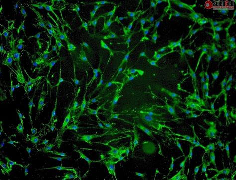 And you will notice the same thing after taking this vitamin regularly. Human Hair Dermal Papilla Cells, HHDPC