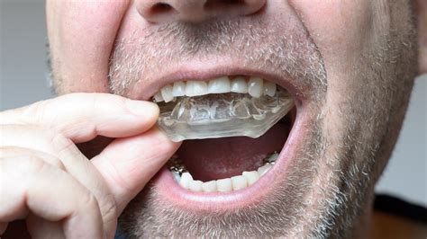Your Nighttime Mouthguard Could Mess Up Your Whole Bite Vice